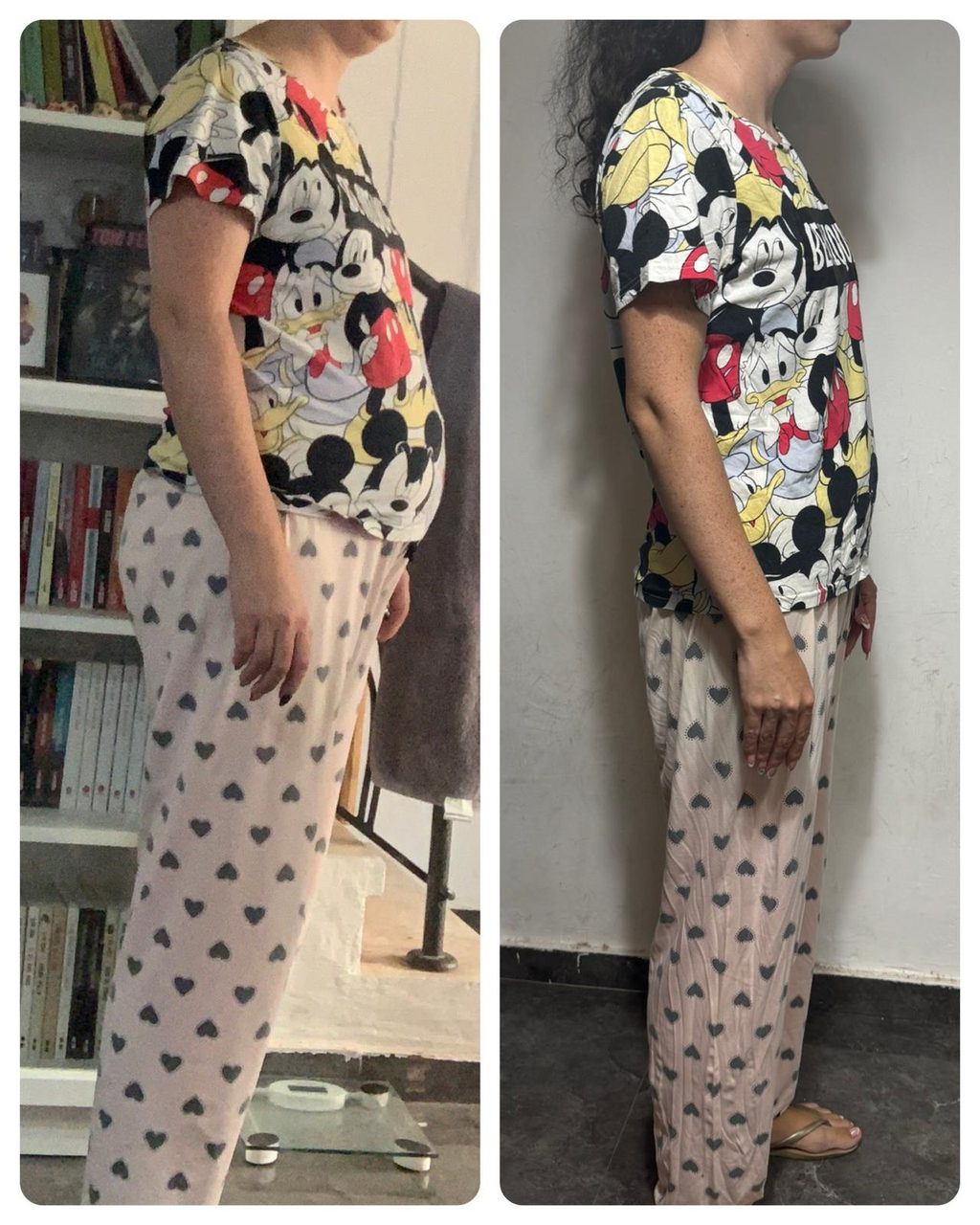לפני ואחרי – שינוי בפרופיל הגוף אצל לקוחה בתהליך